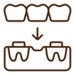 dental-bridge (2)